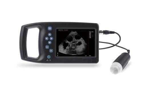 Mechanical B/W Ultrasound Scanner