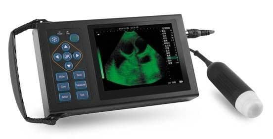 Mechanical B/W Ultrasound Scanner