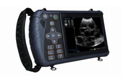 Digital B/W Ultrasound Scanner