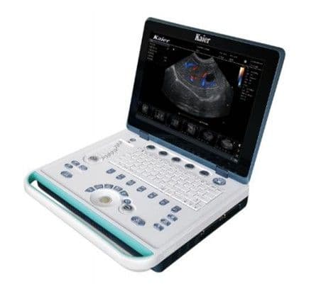 Color Doppler Ultrasound Scanner