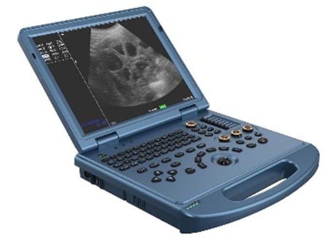 Color Doppler Ultrasound Scanner