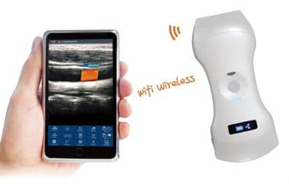 Double Head Probe Type Wireless Ultrasound Scanner