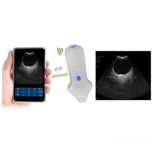 Micro-convex Probe Type Wireless Color Doppler Scanner