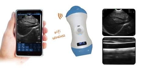 Micro - convex+Linear Probe Type Wireless Color Doppler Scanner