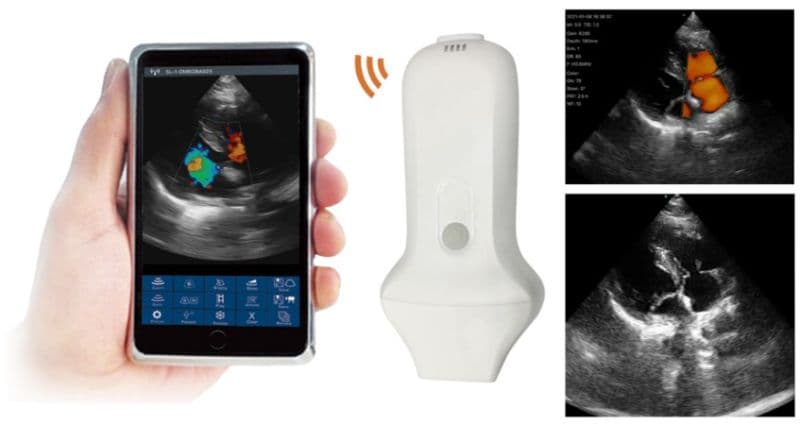 Phased Array Probe Type Wireless Color Doppler Scanner