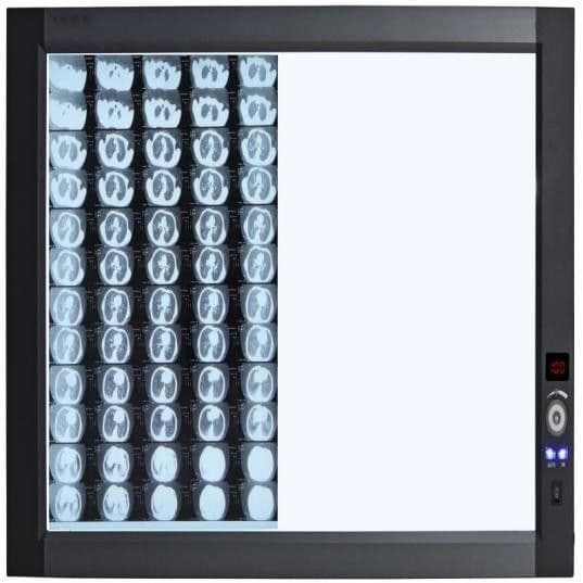 Negatoskop rentgenowski LED ZG-1B/2B/3B/4B - View 2